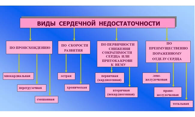 Виды сердечной недостаточности